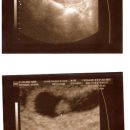prvi ultrazvok 8. teden (21.2.07)